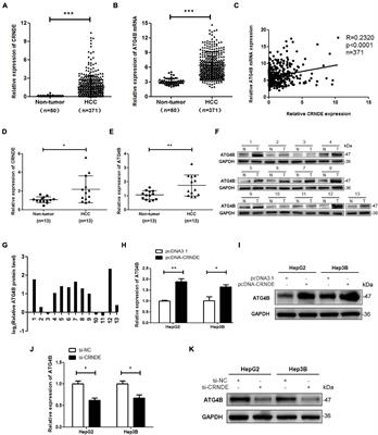 LncRNA CRNDE Promotes ATG4B-Mediated Autophagy and Alleviates the Sensitivity of Sorafenib in Hepatocellular Carcinoma Cells